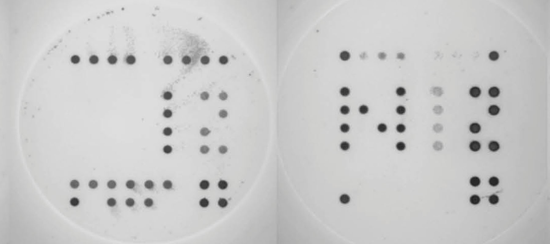 Biomarkers CoViDiag+