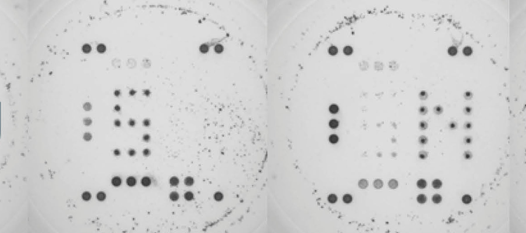Biomarkers CoViDiag